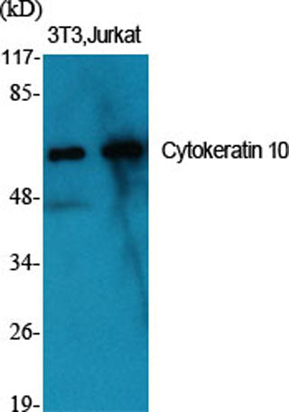 Cytokeratin 10 rabbit pAb