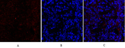 Cytokeratin 18 rabbit pAb