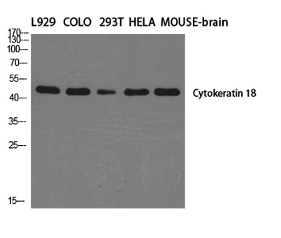 Cytokeratin 18 rabbit pAb