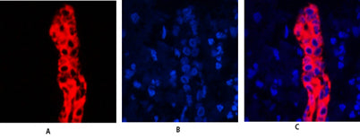 Cytokeratin 19 rabbit pAb