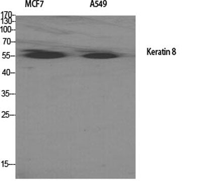 Cytokeratin 8 rabbit pAb