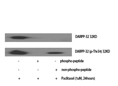 DARPP-32 rabbit pAb
