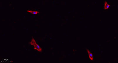 eIF2α rabbit pAb