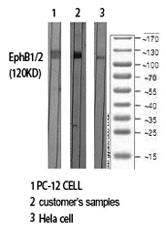 EphB1/2 rabbit pAb