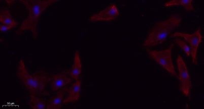 TGFβ RI rabbit pAb