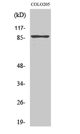 TLK2 rabbit pAb
