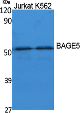 BAGE5 rabbit pAb