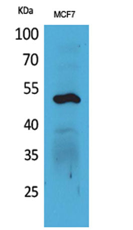 Cytokeratin 14 rabbit pAb