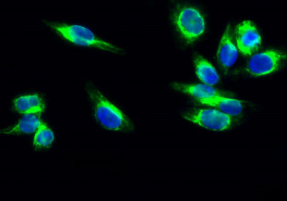Cdk4 rabbit pAb