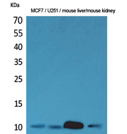 ACBP rabbit pAb
