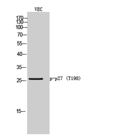 p27 (phospho Thr198) rabbit pAb
