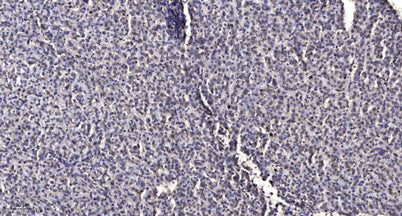 PAK4 (phospho Ser474) rabbit pAb
