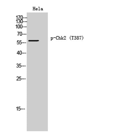 Chk2 (phospho Thr387) rabbit pAb