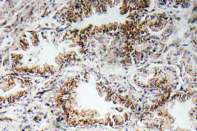 AChRα1 rabbit pAb