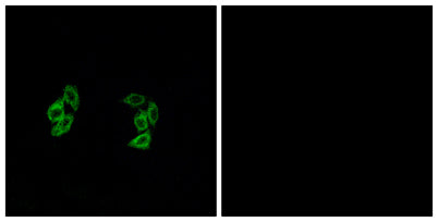 Casein Kinase I α1/1L rabbit pAb