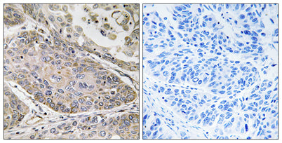 cPLA2-ε rabbit pAb