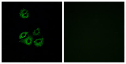 Chemokine Receptor D6 rabbit pAb