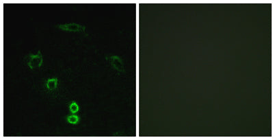 Glycerate Kinase rabbit pAb