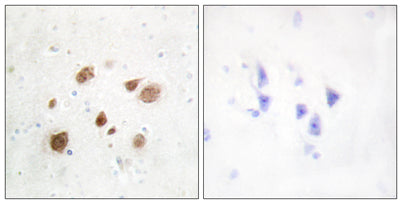 CaMKIβ rabbit pAb