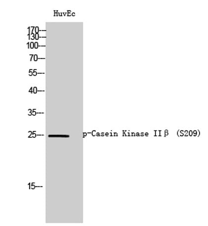 Casein Kinase IIβ (phospho Ser209) rabbit pAb