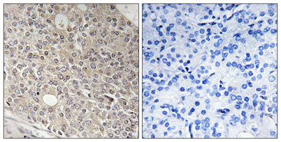 Angiomotin-L1 rabbit pAb