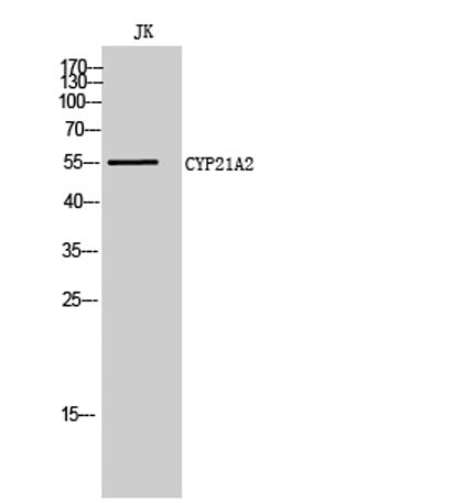 CYP21A2 rabbit pAb
