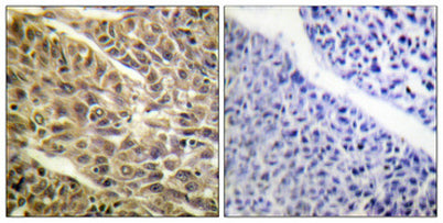 DAPK1 (phospho Ser308) rabbit pAb