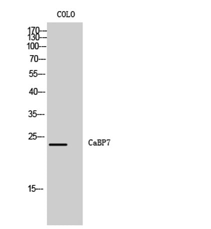 CaBP7 rabbit pAb