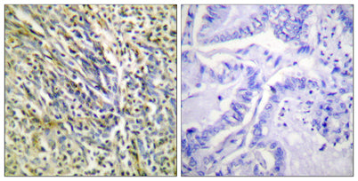 Cleaved-Aggrecan (D369) rabbit pAb