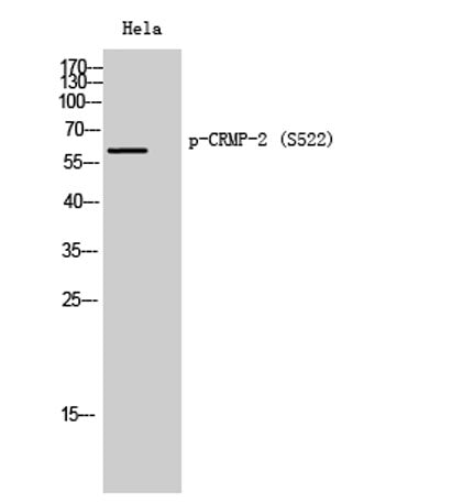 CRMP-2 (phospho Ser522) rabbit pAb