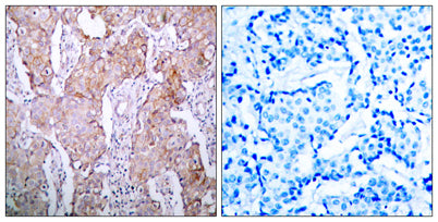 EGFR (phospho Ser1070) rabbit pAb