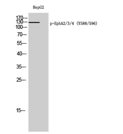 EphA2/3/4 (phospho Tyr588/596) rabbit pAb