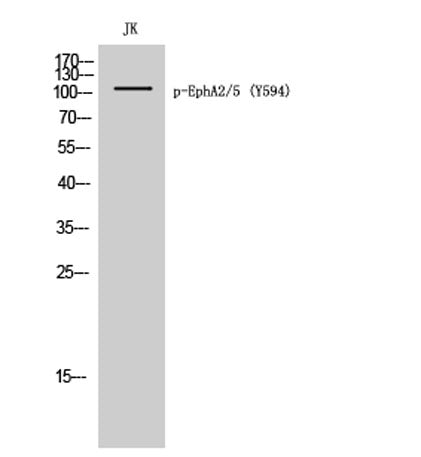 EphA2/5 (phospho Tyr594) rabbit pAb