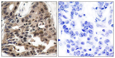 4E-BP1 rabbit pAb