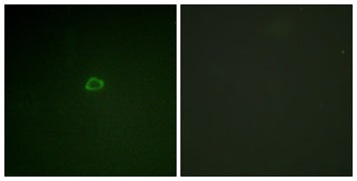 4E-BP1 rabbit pAb