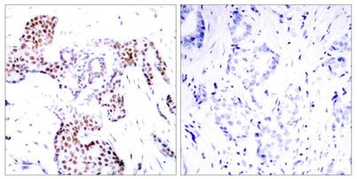 Elk-1 (phospho Ser389) rabbit pAb