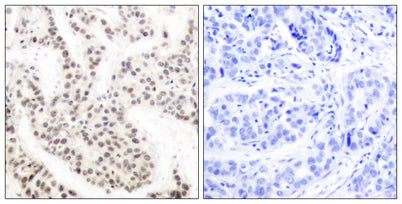 Elk-1 (phospho Thr417) rabbit pAb