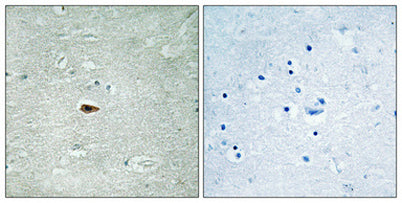 ErbB-3 (phospho Tyr1328) rabbit pAb