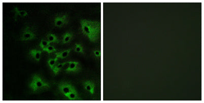 ErbB-4 (phospho Tyr1284) rabbit pAb