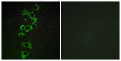 ErbB-4 rabbit pAb