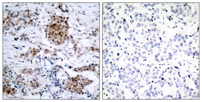 ERα (phospho Ser167) rabbit pAb