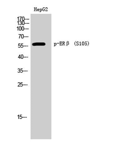 ERβ (phospho Ser105) rabbit pAb