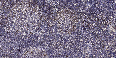 ERβ (phospho Ser87) rabbit pAb