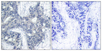 PYK2 (phospho Tyr402) rabbit pAb