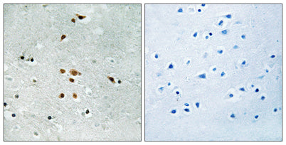 Fer (phospho Tyr402) rabbit pAb