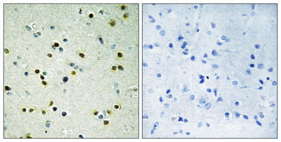 JMJD2B rabbit pAb