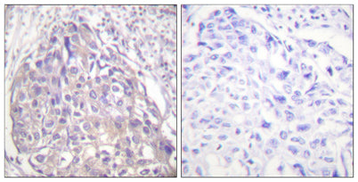 FoxO1/3/4 (phospho Thr24/32) rabbit pAb