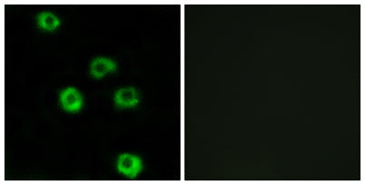Latrophilin-2 rabbit pAb