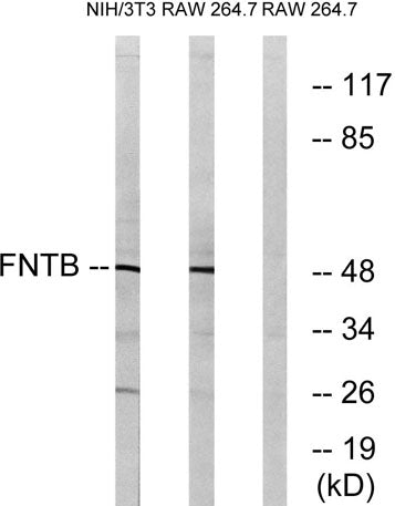FTβ rabbit pAb