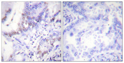Abl1/2 (phospho Tyr393/439) rabbit pAb
